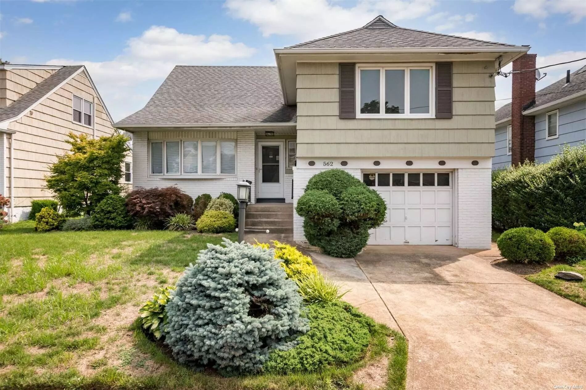 562 Albemarle, Cedarhurst, NY, 11516 MLS 3333914 Avid Homes Inc